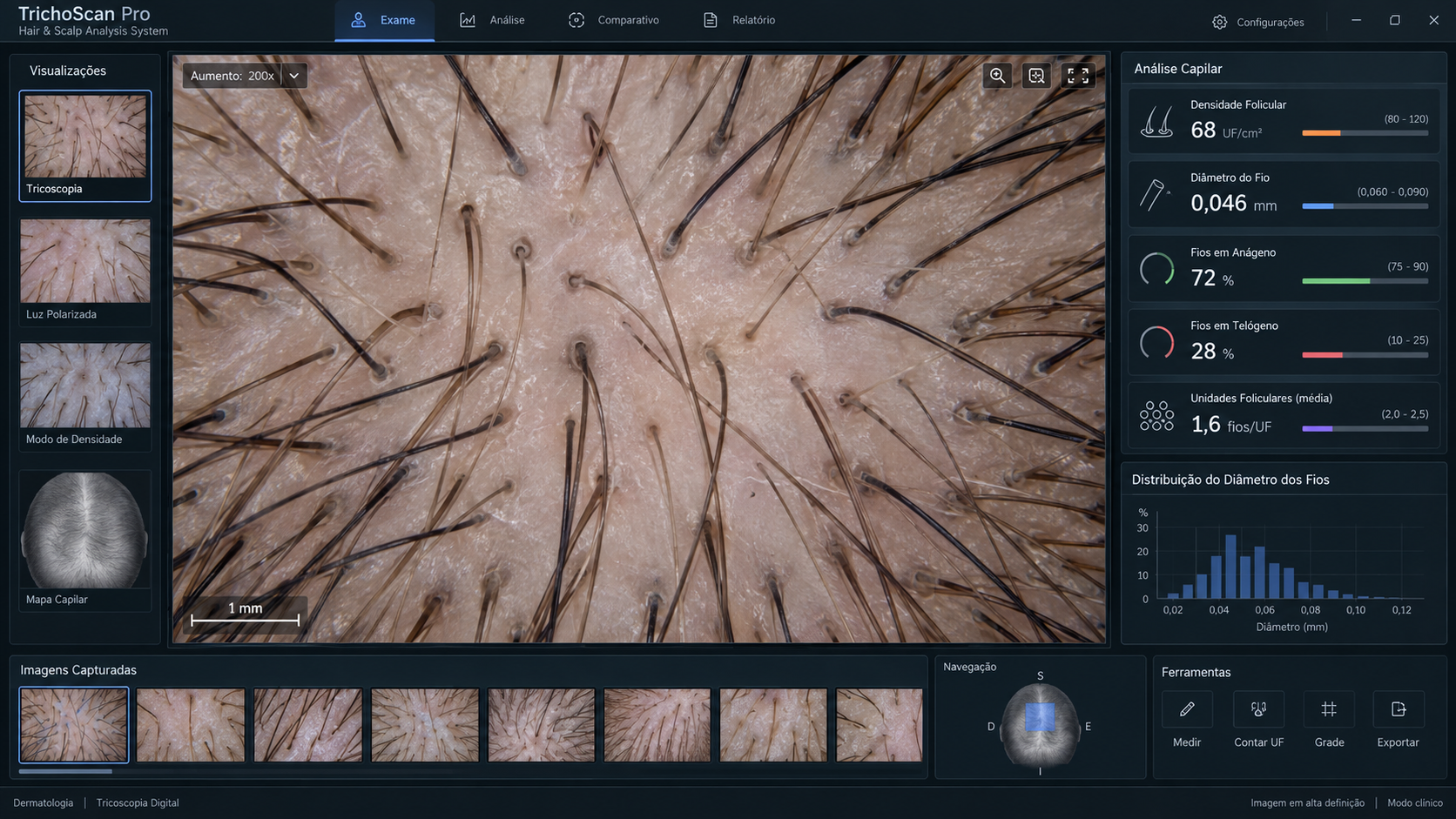 Tricoscopia digital em São Paulo mostrando ampliação do couro cabeludo para diagnóstico de queda de cabelo feminina