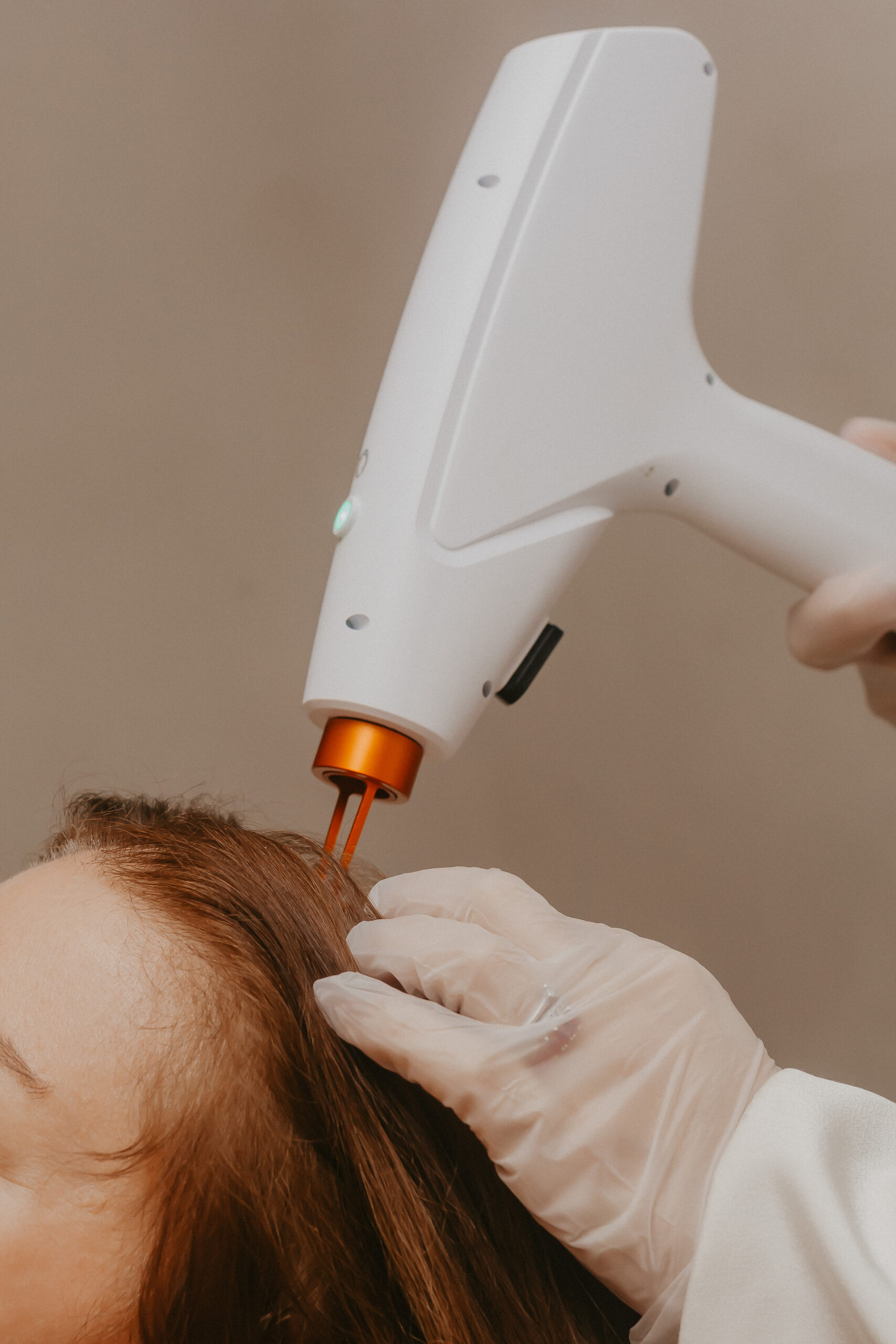 Médica tricologista próxima à Aclimação realizando avaliação capilar feminina com tricoscopia digital na Oasyum São Paulo